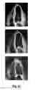 Fig. 07 - Image segmentation based on a shape-guided deformable model driven by a fully convolutional network prior