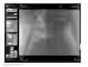 Fig. 01 - Image-based guidance for device path planning based on penalty function values and distances between ROI centerline and backprojected instrument centerline