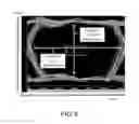 Fig. 07 - Main board and computer apparatus with connectors of both dual in-line package and surface mount technology