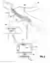 Fig. 05 - Systems and methods for pre-operative procedure determination and outcome predicting