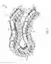 Fig. 07 - Snag mitigating cable track apparatus