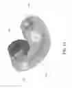 Fig. 13 - Shock absorptive helmet—facemask interconnect