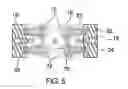 Fig. 05 - Cleaning assembly