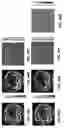 Fig. 32 - Single-impulse panoramic photoacoustic computed tomography (SIP-PACT)