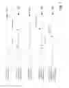 Fig. 12 - Method and apparatus for measurement of neural response