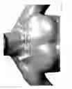 Fig. 06 - Body-worn sensor for characterizing patients with heart failure