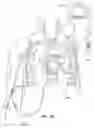 Fig. 16 - Systems and methods for visualizing anatomy, locating medical devices, or placing medical devices