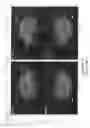 Fig. 02 - ULTRASOUND IMAGING TRACKING CONTROLLED PRESENTATION