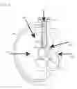 Fig. 02 - Devices and method for access and visualization for lumbar interbody fusion (LIF)