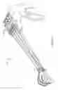 Fig. 49 - Devices for cardiac surgery and methods thereof