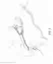 Fig. 10 - Method of applying staples to liver and other organs