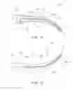 Fig. 13 - Method of applying staples to liver and other organs