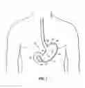 Fig. 02 - End effectors, surgical stapling devices, and methods of using same