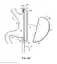 Fig. 06 - End effectors, surgical stapling devices, and methods of using same