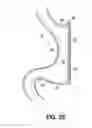 Fig. 07 - End effectors, surgical stapling devices, and methods of using same