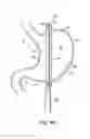 Fig. 43 - End effectors, surgical stapling devices, and methods of using same