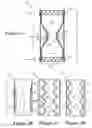 Fig. 06 - IMPLANTABLE DAMPING DEVICES FOR TREATING DEMENTIA AND ASSOCIATED SYSTEMS AND METHODS OF USE