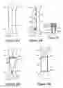 Fig. 09 - IMPLANTABLE DAMPING DEVICES FOR TREATING DEMENTIA AND ASSOCIATED SYSTEMS AND METHODS OF USE