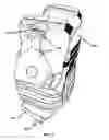 Fig. 06 - Wearable blood flow occlusion device