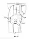 Fig. 12 - Wearable blood flow occlusion device
