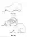 Fig. 16 - Wearable blood flow occlusion device