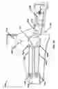 Fig. 19 - Wearable blood flow occlusion device