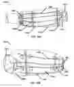 Fig. 20 - Wearable blood flow occlusion device