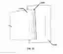 Fig. 22 - Wearable blood flow occlusion device