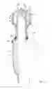 Fig. 07 - Treatment instrument that includes an operation dial