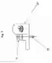 Fig. 04 - Sacral-iliac stabilization system