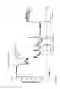 Fig. 08 - Catheter stability indication