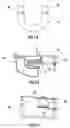Fig. 06 - Elastically deformable bite fork stabilizer and associated methods