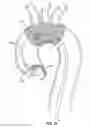 Fig. 06 - Embolic protection device