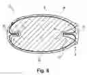 Fig. 06 - Embolic protection device, folding method and forming device