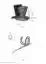 Fig. 02 - Embolic device with improved neck coverage