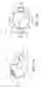 Fig. 33 - Prosthetic capsular devices, systems, and methods