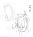 Fig. 77 - Prosthetic capsular devices, systems, and methods