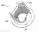 Fig. 01 - STENT-VALVES FOR VALVE REPLACEMENT AND ASSOCIATED METHODS AND SYSTEMS FOR SURGERY