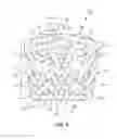 Fig. 09 - Implant with bone contacting elements having helical and undulating planar geometries