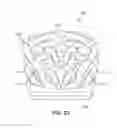 Fig. 22 - Implant with bone contacting elements having helical and undulating planar geometries