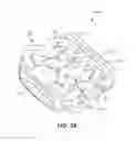 Fig. 33 - Implant with bone contacting elements having helical and undulating planar geometries