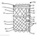 Fig. 01 - EXPANDABLE CORPECTOMY IMPLANT