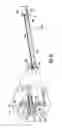 Fig. 17 - Expandable sheath