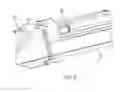 Fig. 19 - IUD insertion devices