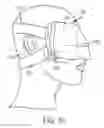 Fig. 09 - Systems and Methods for Providing a Cooling Compression Apparatus for Post-Surgery Recovery