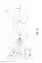 Fig. 02 - Elasticized absorbent articles and methods of weakening elastic portions in elasticized absorbent articles