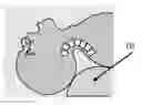 Fig. 01 - Device to Provide Optimal Positioning for Endotracheal Intubation or Cricothyroidotomy in the Emergency Department, in the Operating Room, and by First Responders on the Scene of Emergency Situations