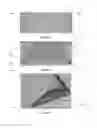 Fig. 07 - Device to Provide Optimal Positioning for Endotracheal Intubation or Cricothyroidotomy in the Emergency Department, in the Operating Room, and by First Responders on the Scene of Emergency Situations