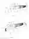 Fig. 04 - Motion-liberating smart walking stick