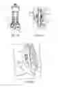 Fig. 25 - Protector housing plastic spike with flash intended for DVO last drop extraction